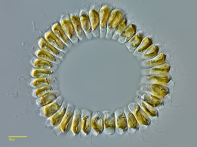 Leben im Teich KranzGoldalge (Cyclonexis annularis), Chrysophyceae